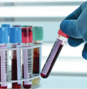 Types of Haematology Oncology Treatment In Udaipur